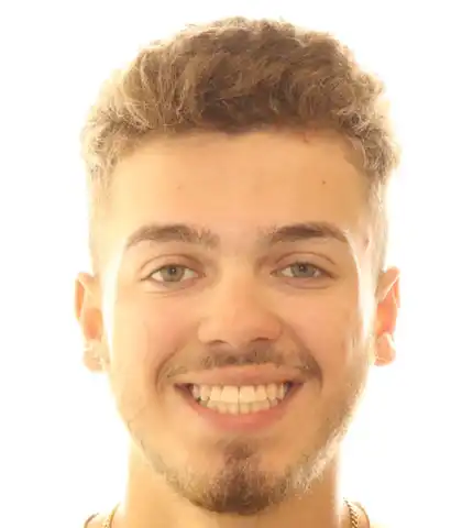 The same teenage patient after orthodontic treatment with an aligned, even smile