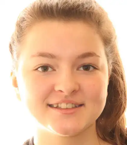 Young woman before orthodontic treatment showing uneven upper front teeth