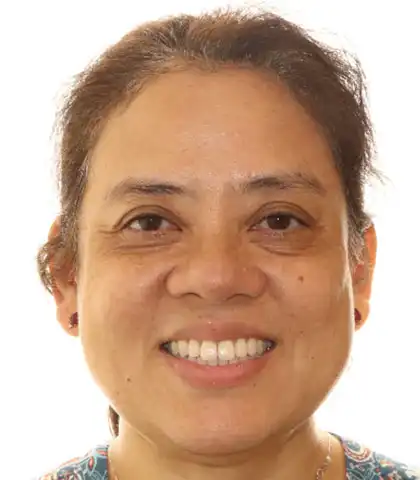 The same adult patient after treatment with a straight, even smile