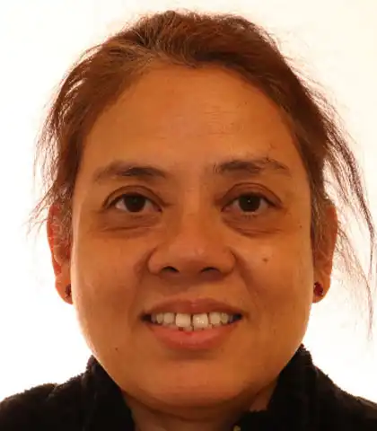 Adult patient before orthodontic treatment with uneven front teeth