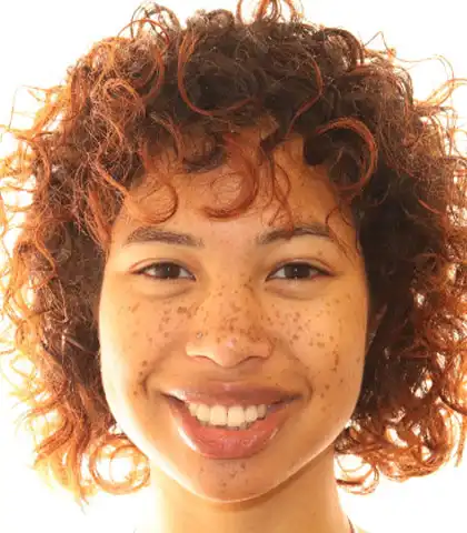 Young woman before orthodontic treatment with uneven upper front teeth
