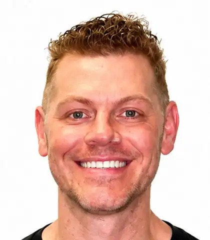 The same adult patient after treatment with the gaps closed and an even smile
