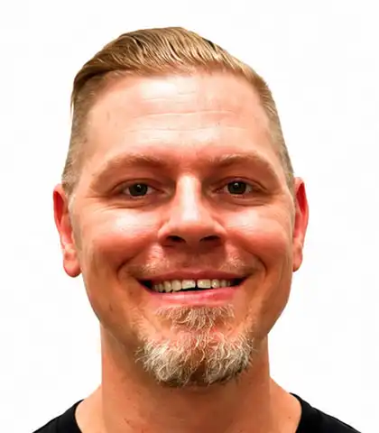Adult man before orthodontic treatment with noticeable gaps between the upper teeth